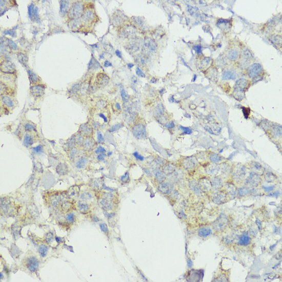 Anti-SOCS6 Polyclonal Antibody (CAB9957)