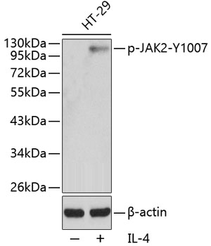 Anti-Phospho-JAK2-Y1007 Antibody (CABP0373)