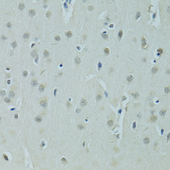 Anti-ZNF346 Antibody (CAB7507)