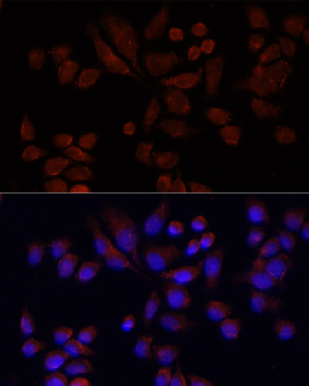 Anti-NAT2 Antibody (CAB12766)