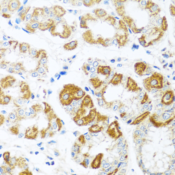 Anti-MCP-1 Antibody (CAB7277)