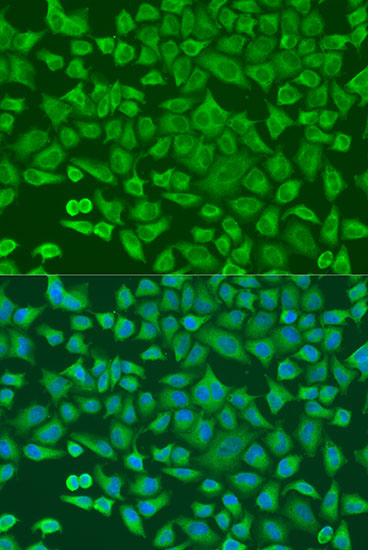 Anti-Albumin Antibody (CAB15638)