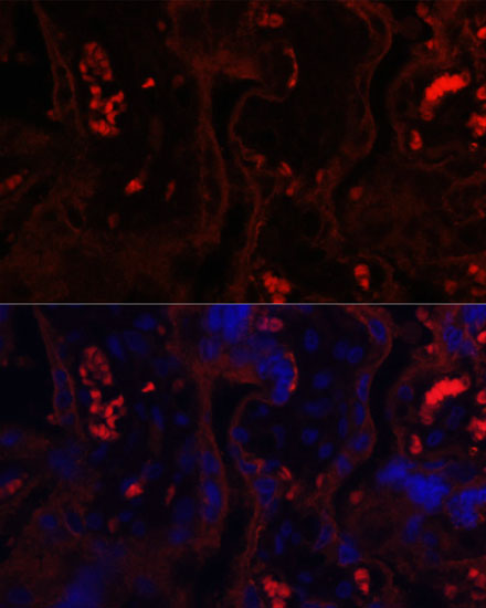 Anti-MME Antibody (CAB5664)