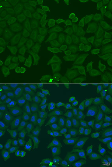 Anti-IFNA6 Antibody (CAB7903)