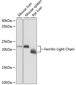 Anti-Ferritin Light Chain Antibody