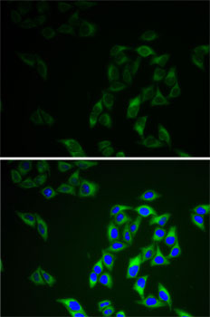 Anti-AK1 Antibody (CAB1218)