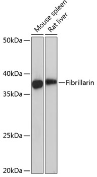 Anti-Fibrillarin Antibody