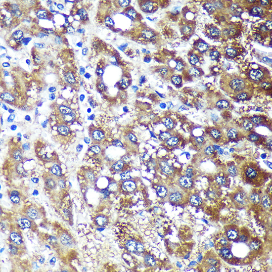 Anti-NDUFAF4 Antibody (CAB14345)