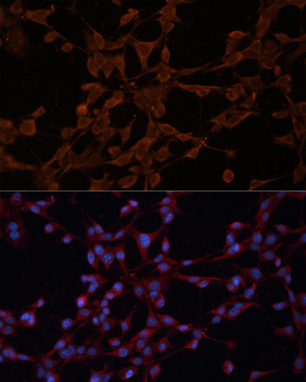 Anti-P Glycoprotein Antibody (CAB11758)