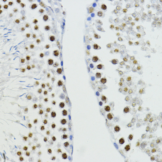 Anti-ZEB1 Antibody (CAB5600)