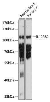 Anti-IL-12RB2 Antibody (CAB10348)