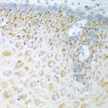 Anti-FDXR Antibody (CAB3860)