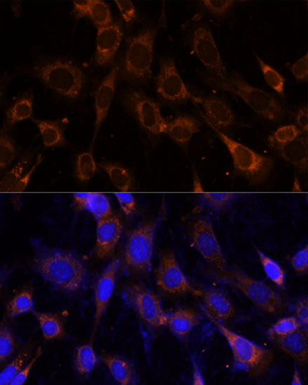 Anti-VPS25 Antibody (CAB13132)