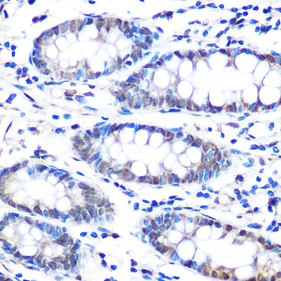 Anti-BACH1 Antibody (CAB5393)