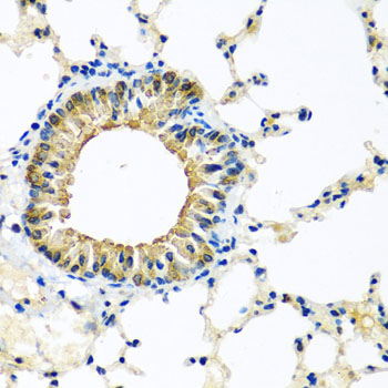 Anti-KCTD15 Polyclonal Antibody (CAB8256)