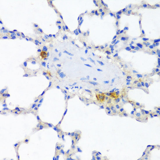 Anti-ITGAX Antibody (CAB1508)