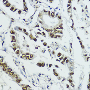 Anti-Phospho-Histone H3-T11 Antibody (CABP0093)