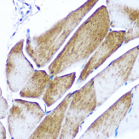 Anti-GLUT4 Antibody (CAB7637)