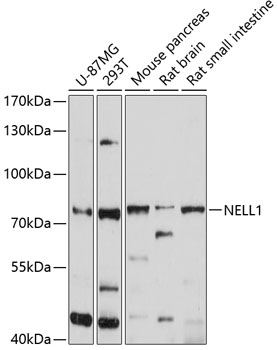 Anti-NELL1 Antibody (CAB10358)