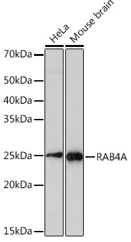 Anti-RAB4A Antibody (CAB3979)