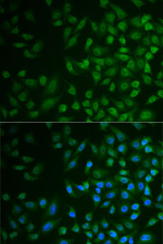 Anti-MPP2 Antibody (CAB6659)