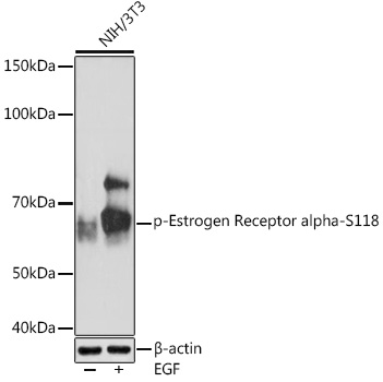 Anti-Phospho-Estrogen Receptor alpha-S118 Antibody (CABP1004)