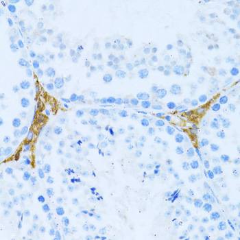 Anti-KLHL42 Antibody (CAB10373)