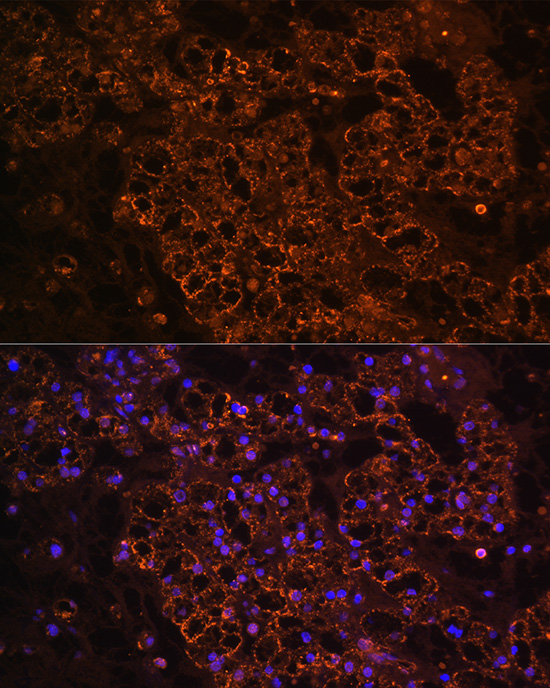 Anti-PCK1 Antibody (CAB2036)