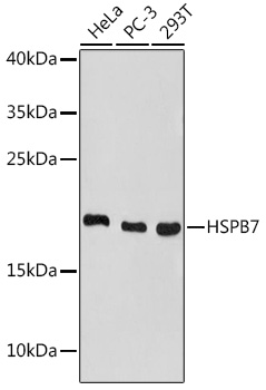 Anti-HSPB7 Antibody (CAB18450)