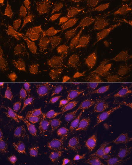 Anti-ACAT1 Antibody (CAB5335)