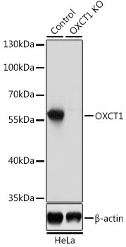 Anti-OXCT1 Polyclonal Antibody [KO Validated] (CAB8139)