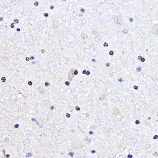 Anti-CDK6 Antibody (CAB16357)