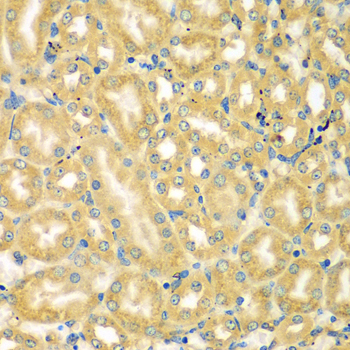 Anti-MOCS3 Antibody (CAB7367)