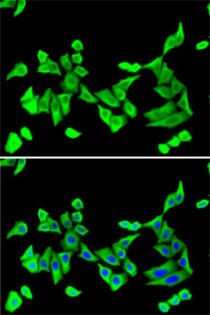 Anti-PTH Antibody (CAB5846)