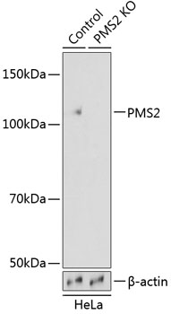 Anti-PMS2 Antibody [KO Validated] (CAB19927)