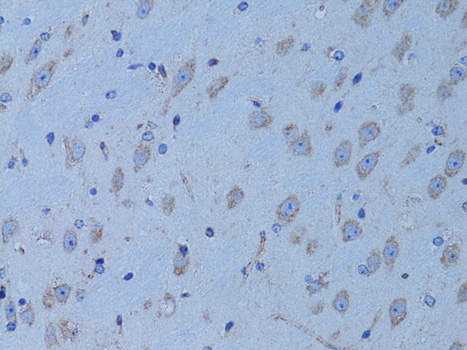 Anti-HADH Antibody (CAB1076)