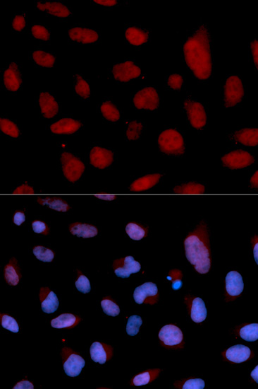 Anti-TNNC1 Antibody (CAB1927)