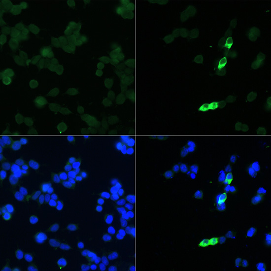 Anti-Mouse anti His-Tag Monoclonal Antibody (CABE003)