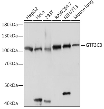 Anti-GTF3C3 Antibody (CAB18405)