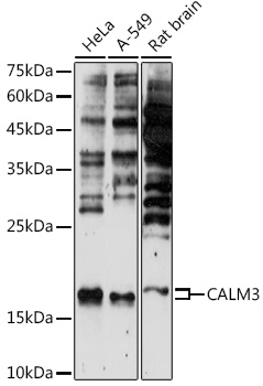 Anti-CALM3 Antibody (CAB14526)