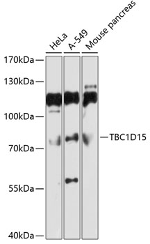 Anti-TBC1D15 Antibody (CAB10593)