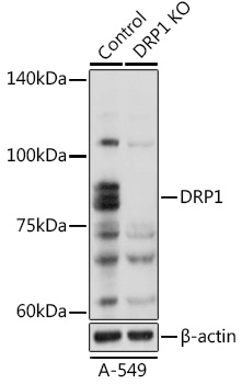 Anti-DRP1 Antibody [KO Validated] (CAB17069)