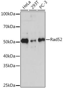 Anti-Rad52 Antibody (CAB5186)