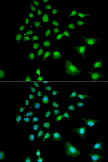 Anti-UBE3C Antibody (CAB6442)