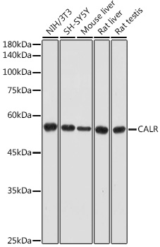 Anti-CALR Antibody [KO Validated] (CAB18013)