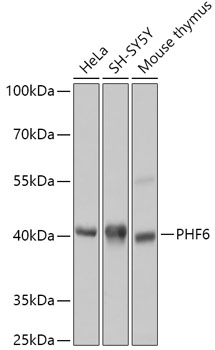 Anti-PHF6 Antibody (CAB18149)