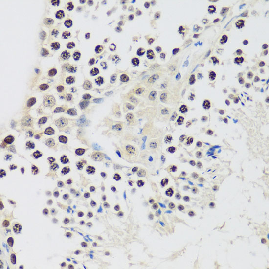 Anti-Cyclin E2 Antibody (CAB4272)