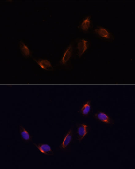 Anti-NTRK1 Antibody (CAB2098)