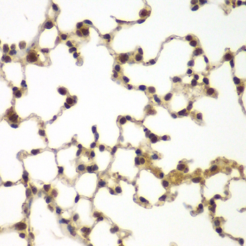 Anti-SULT2B1 Antibody (CAB7736)