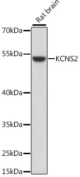 Anti-KCNS2 Antibody (CAB15684)